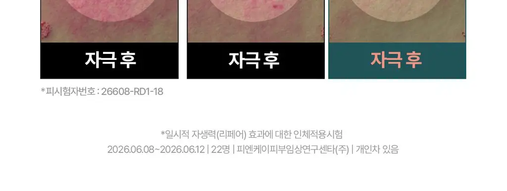 [붉은기 2배 방어_수분 레이어링]리쥬덱스 더마 리페어링 크림 미스트 100ml 상세페이지 10